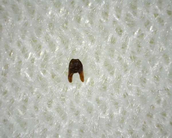 Xenacanthus Permian Shark Tooth #2 - Image 3