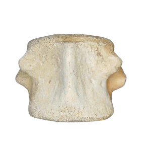 Champsosaurus Cretaceous Age Diapsid Reptile Vertebra from South Dakota #24