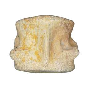 Champsosaurus Cretaceous Age Diapsid Reptile Vertebra from South Dakota #27