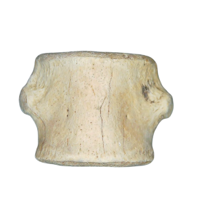 Champsosaurus Cretaceous Age Diapsid Reptile Vertebra from South Dakota #7